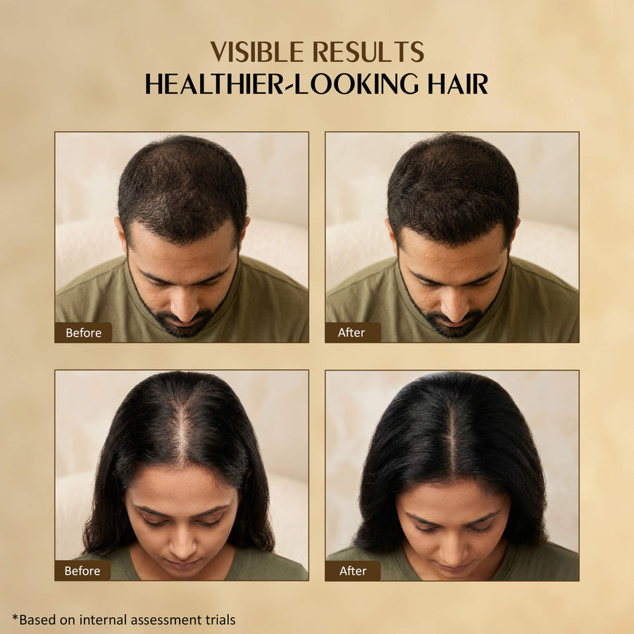 Indian Secrets Hair Growth Oil, 100ml — 5